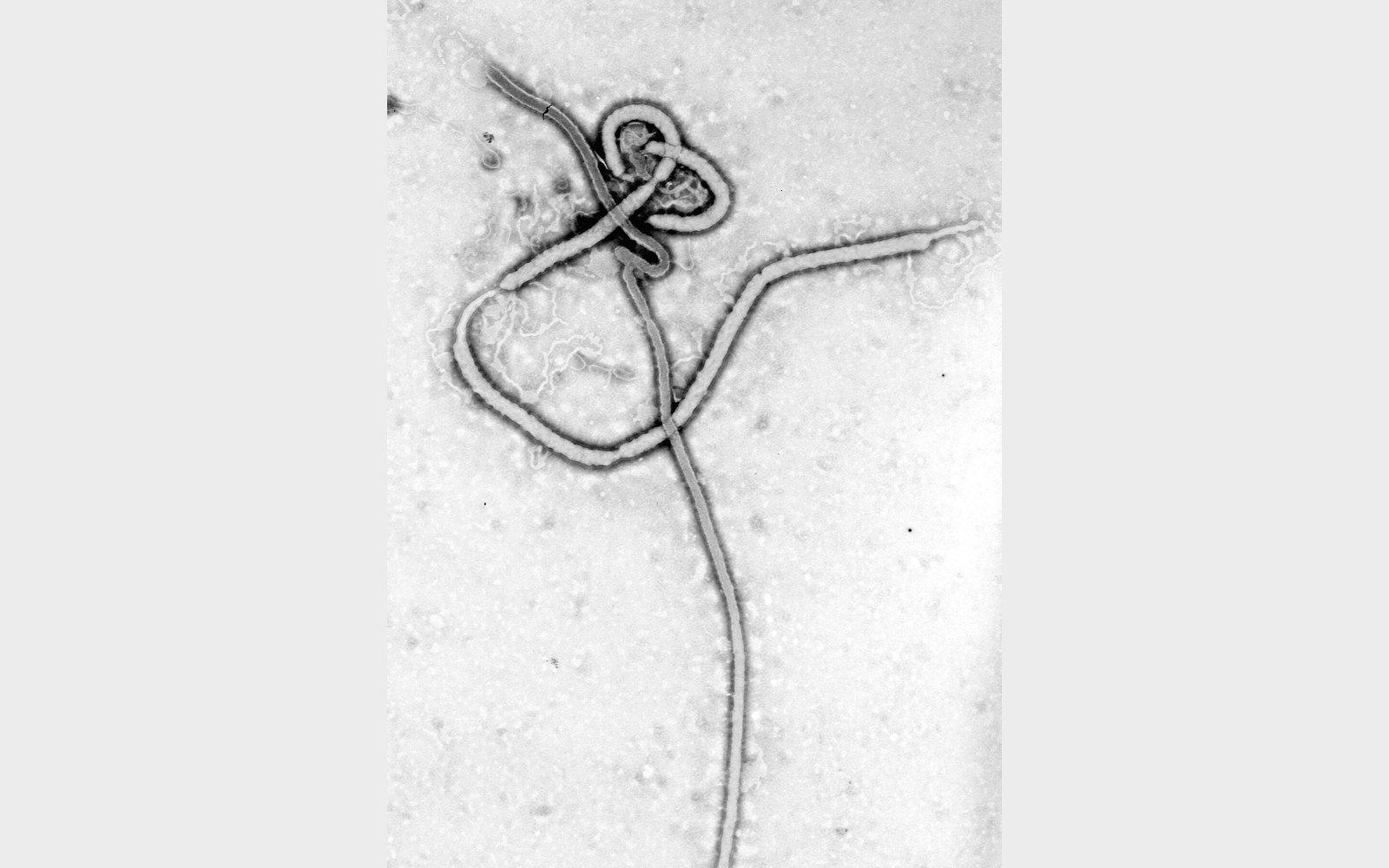 Kongo'daki Ebola Salgınında Vaka Sayısı 10 Bini Aştı: 4 Bin 928 Kişi Hayatını Kaybetti, Kenya ve Nijerya'da da Vakalar Var
