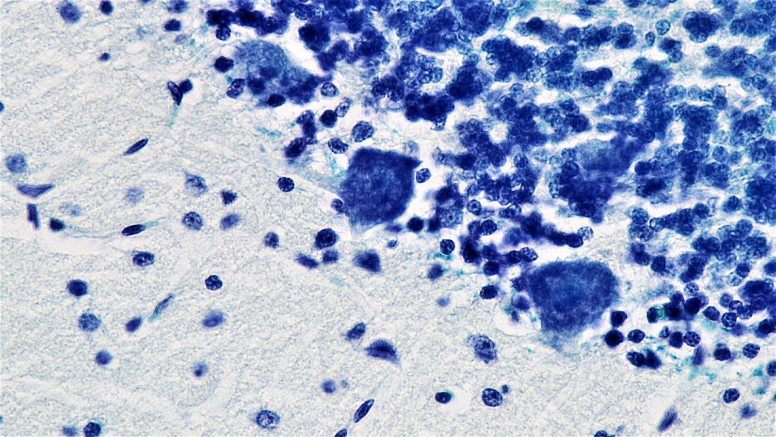 2026 Nobel Tıp Ödülü Optogenetiğin Öncülerine Verildi